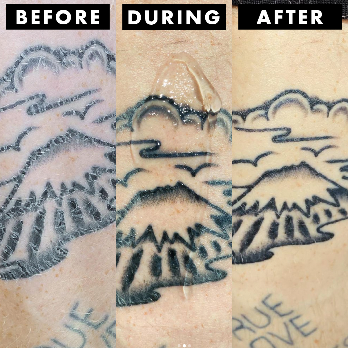 Celebrity Tattoo Removal: Before and After – Tattoo for a week